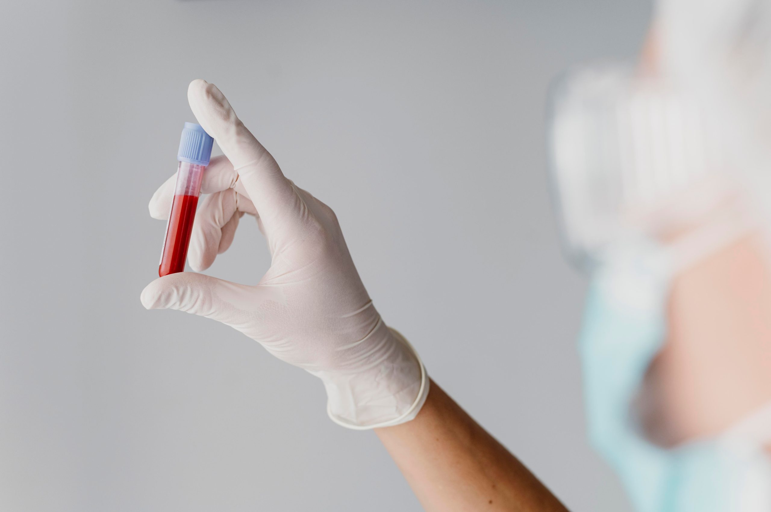 Blood Test
